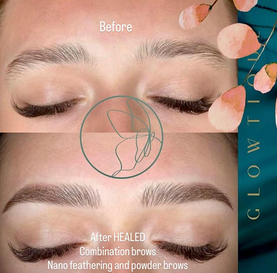 Combination before and after at Glowtique Brisbane